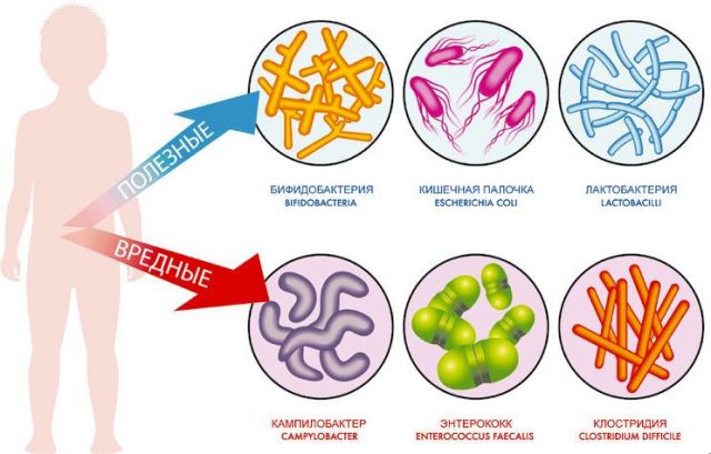 Вредные и полезные бактерии вагинальной микрофлоры