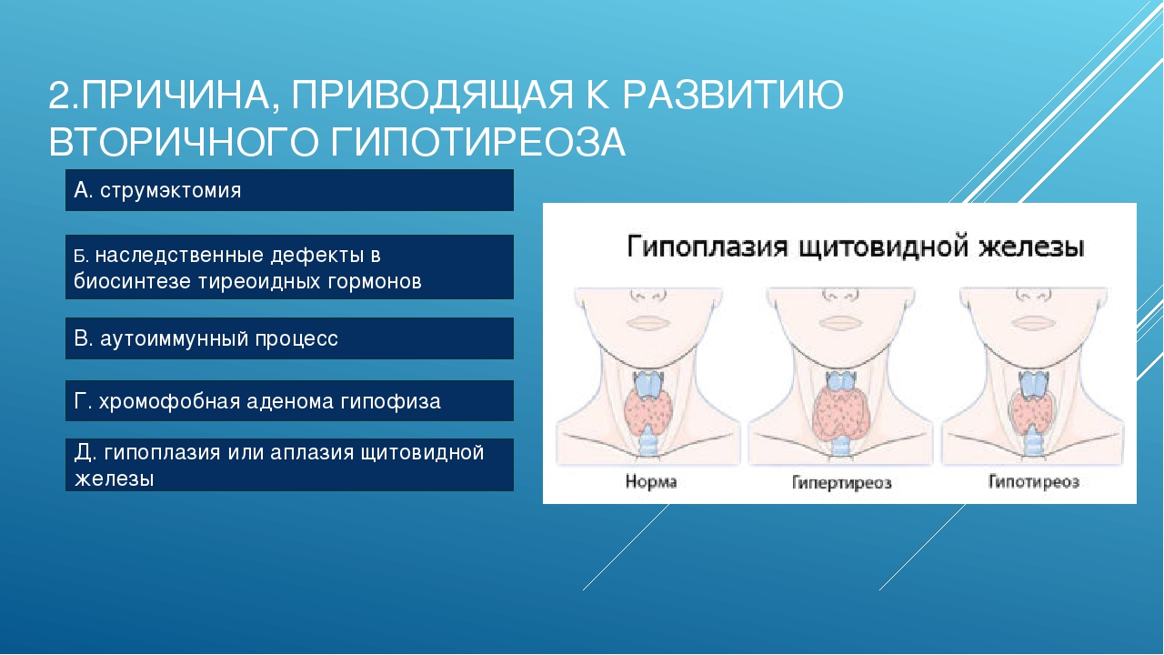 Заболевания щитовидной железы у детей презентация