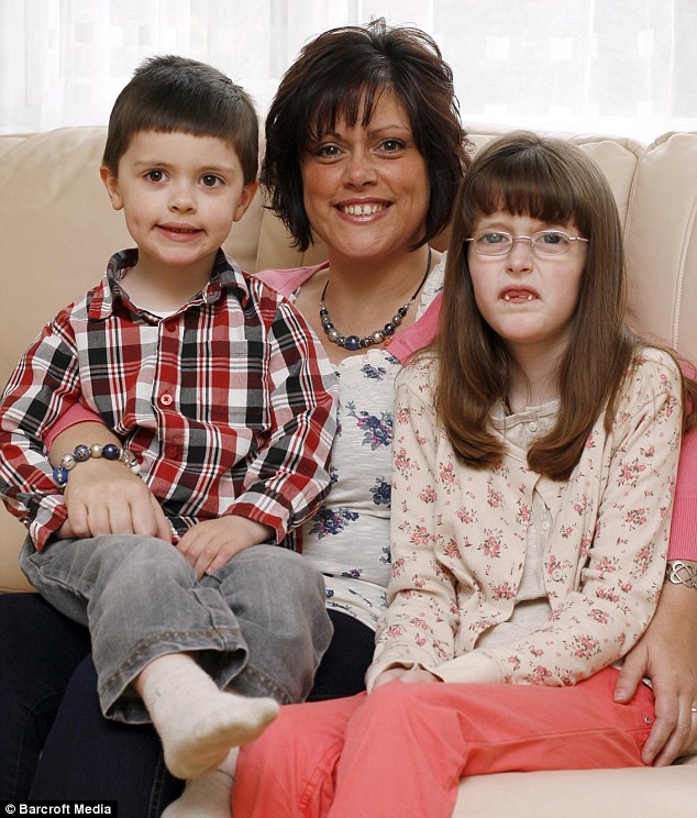 Marfan Syndrome: the condition means Sophie has elongated limbs and fingers