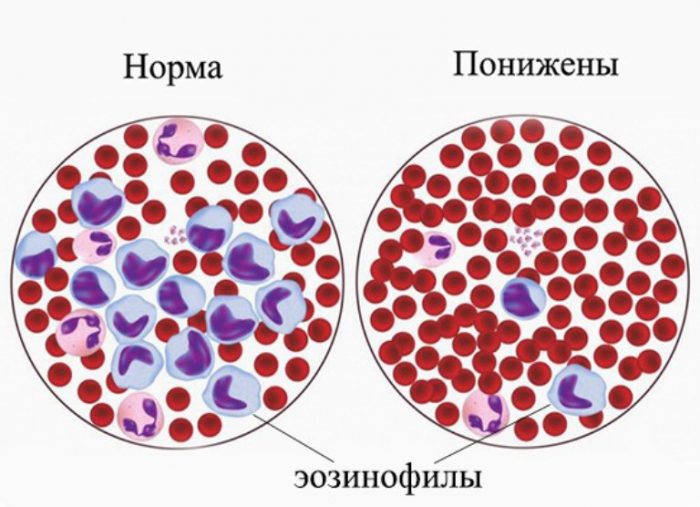 Показатели эозинофилов