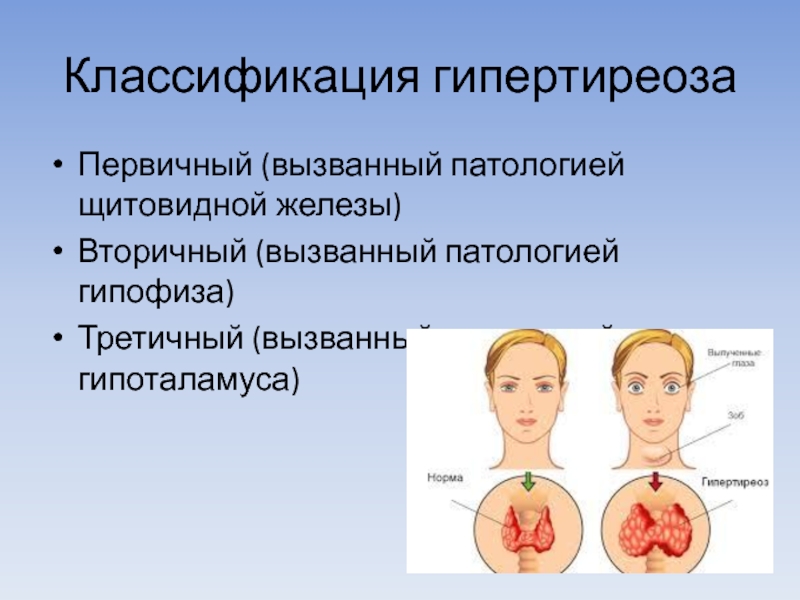 Заболевания щитовидной железы у детей презентация