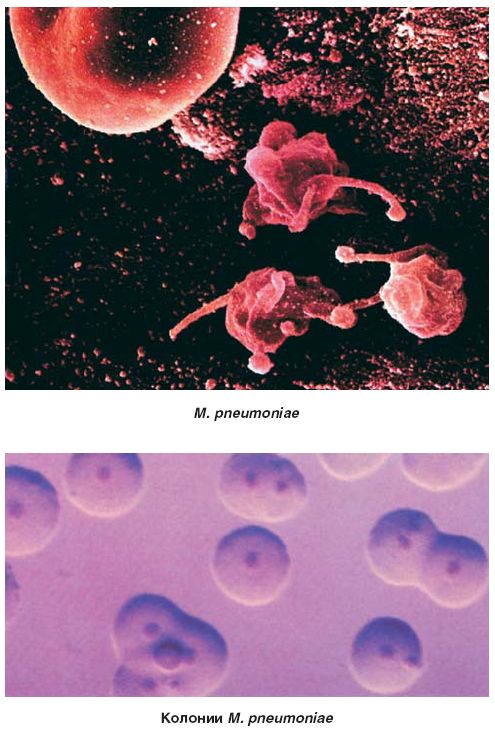 Mycoplasma pneumoniae